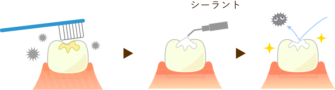 C0・C1の治療・ケア